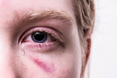 trauma-3485235_1280.jpg trauma-3485235_1280.jpg